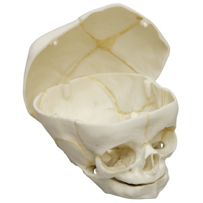 Foetal Human Skull Model with Calvarium Cut