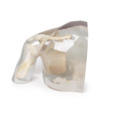 Erler-Zimmer X-ray Phantom Shoulder Model