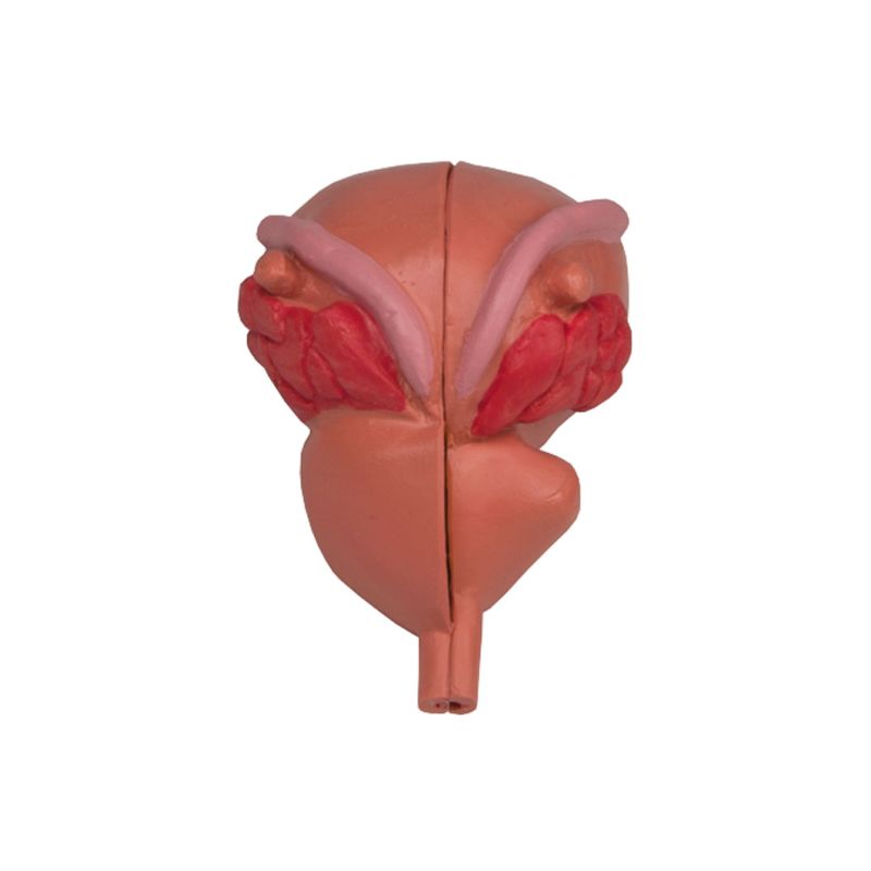 2-Part Model Prostate