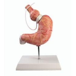 Anatomical Model of Stomach with Gastric Band :: Sports Supports ...