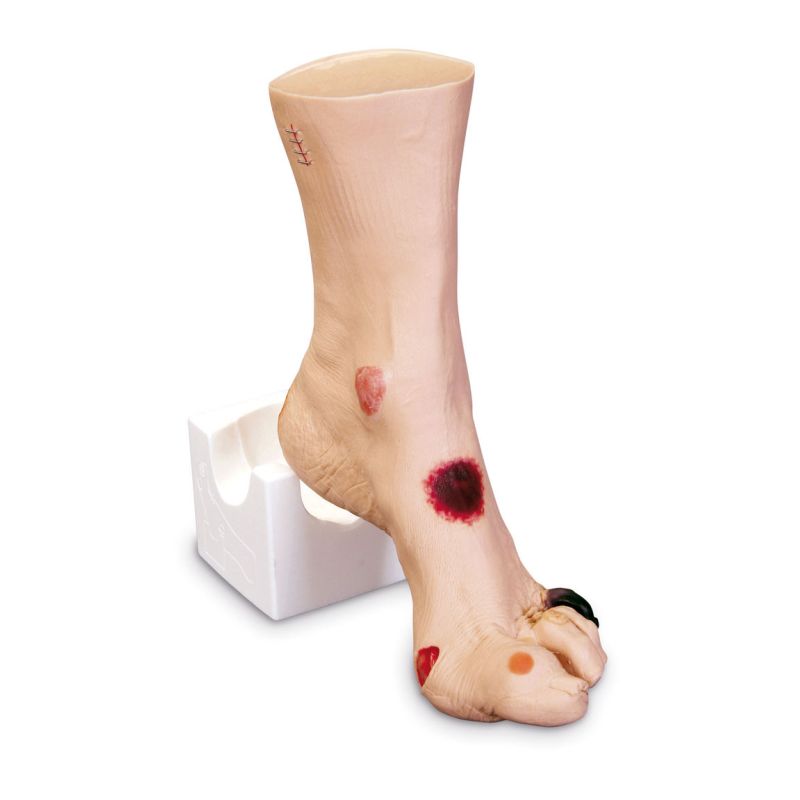 Wound Foot 'Wilma' :: Sports Supports | Mobility | Healthcare Products