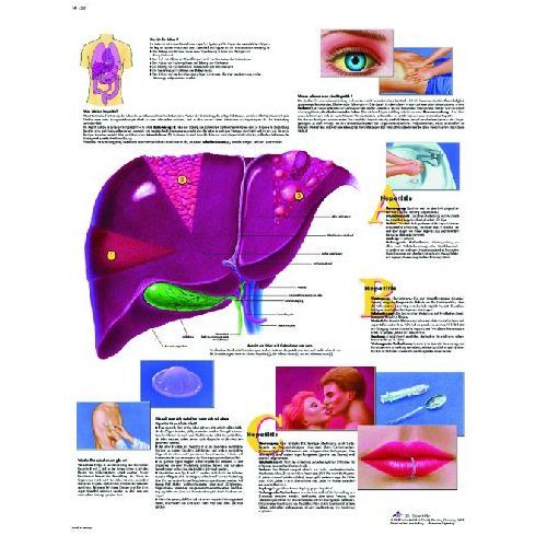 Hepatitis Chart | Health and Care