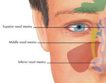 Laminated Rhinitis and Sinusitis Information Poster Chart (50 x 67cm ...