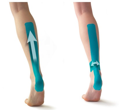 KT Tape - Kinesiology Taping Instructions for IT Band pain 