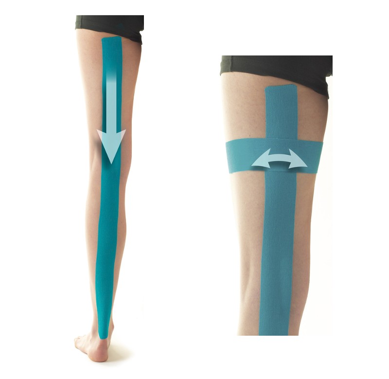 Kinesiology Taping for IT Band