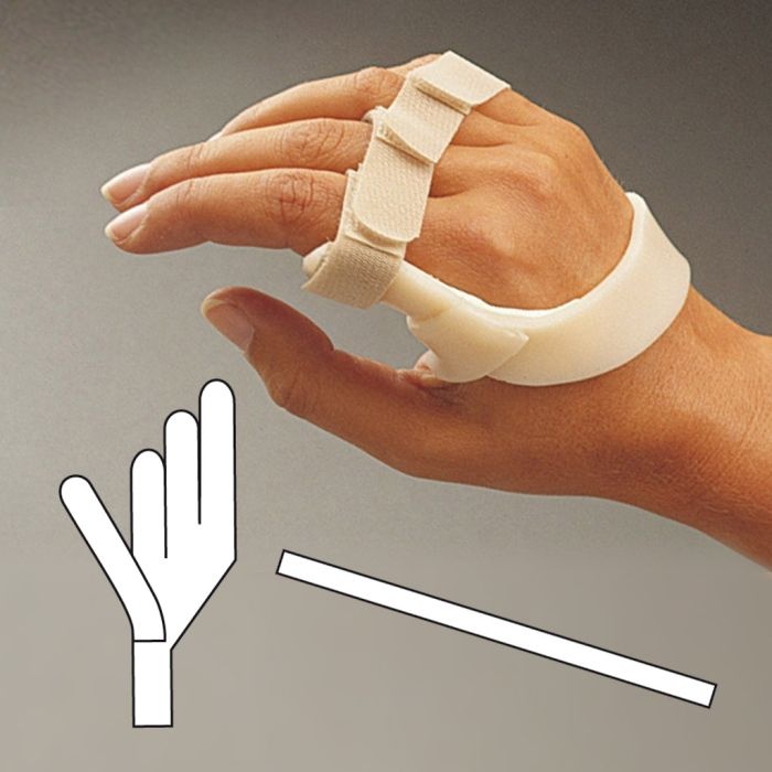 Alimed Long Ulnar Deviation Wrist Splint - vrogue.co