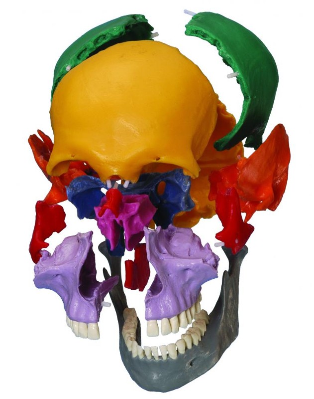 Rudiger Coloured Human Skull Model Dissected