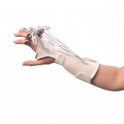 Dynamic Splinting | Health And Care