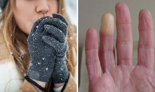 Writing Gloves: how to write when your hands get cold